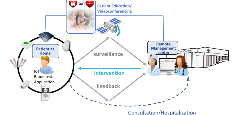 Remote monitoring network of the Bordeaux University Hospital